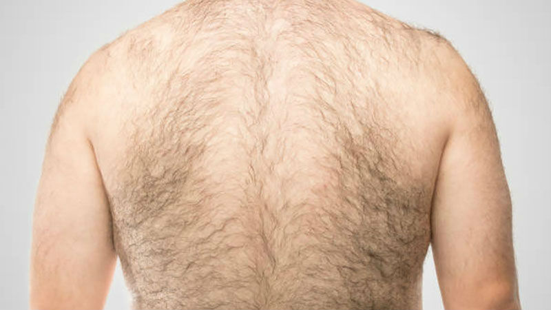 Как избавиться от волос на спине мужчине